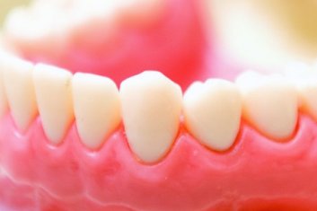 PROTETİK DİŞ TEDAVİSİ